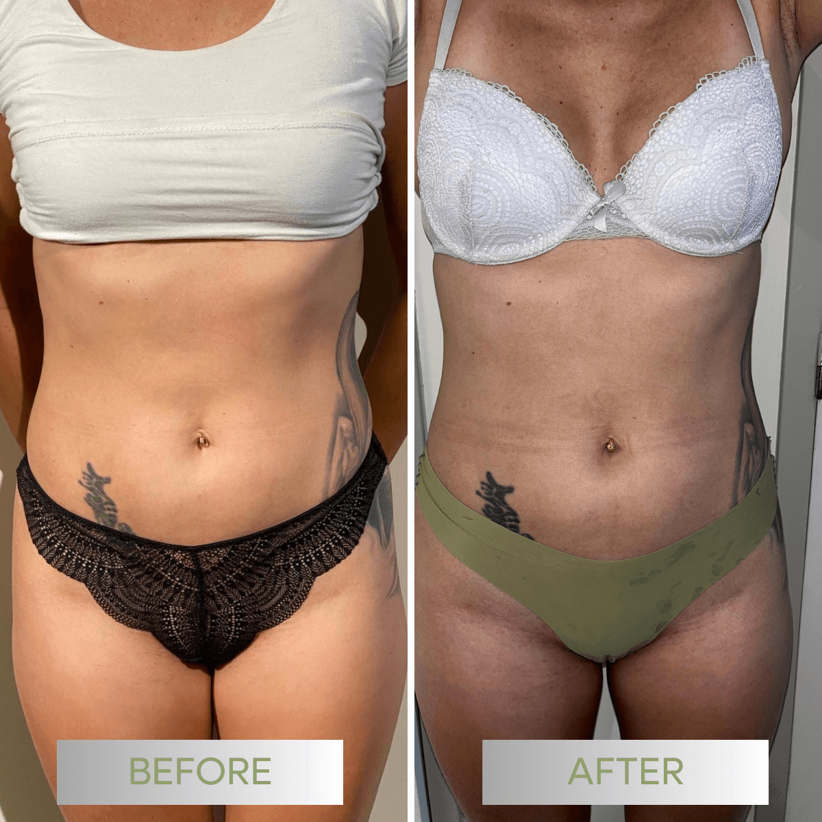 04-avant-apres-be-fit-au