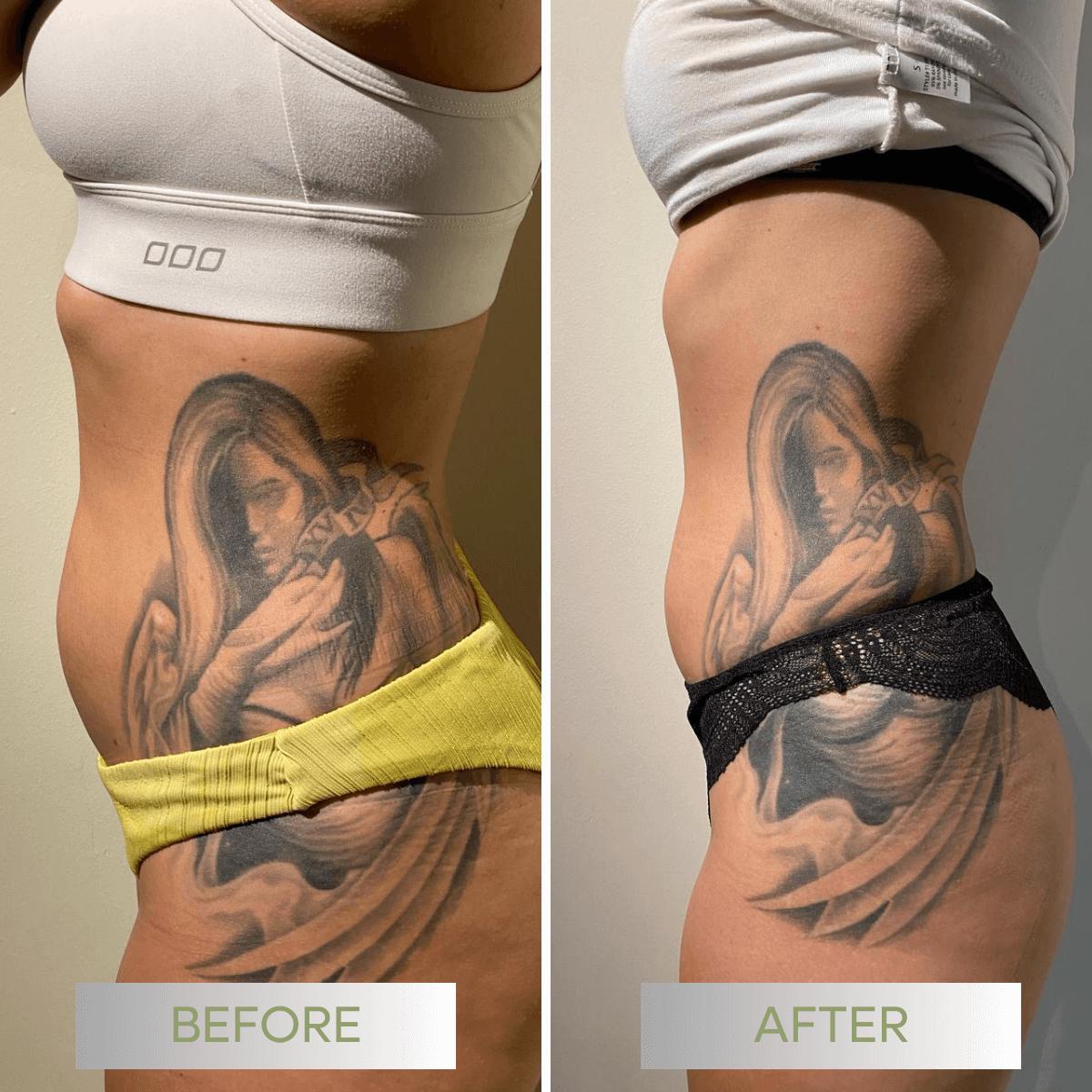 06-avant-apres-be-fit-au