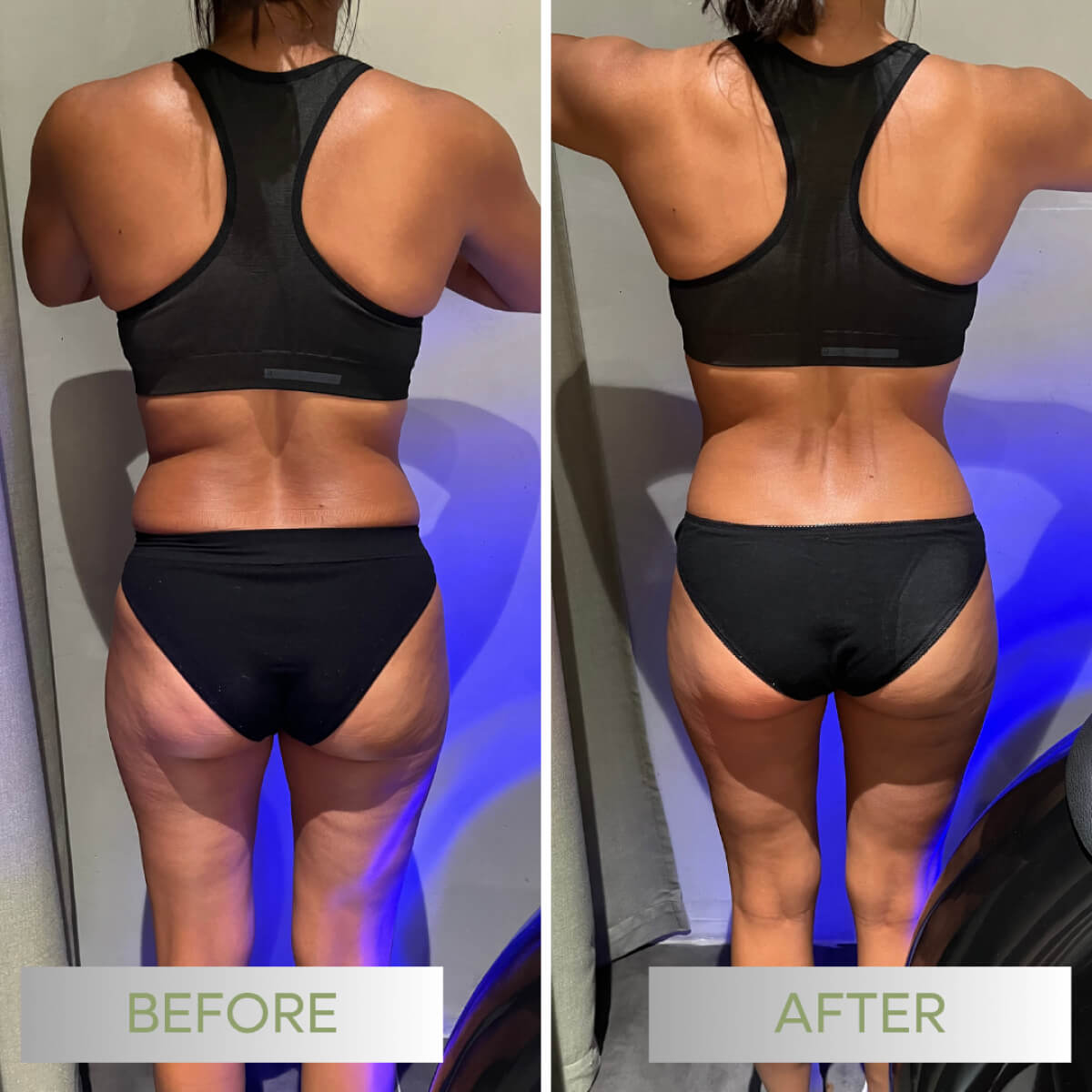 Befit-avantapres-001b