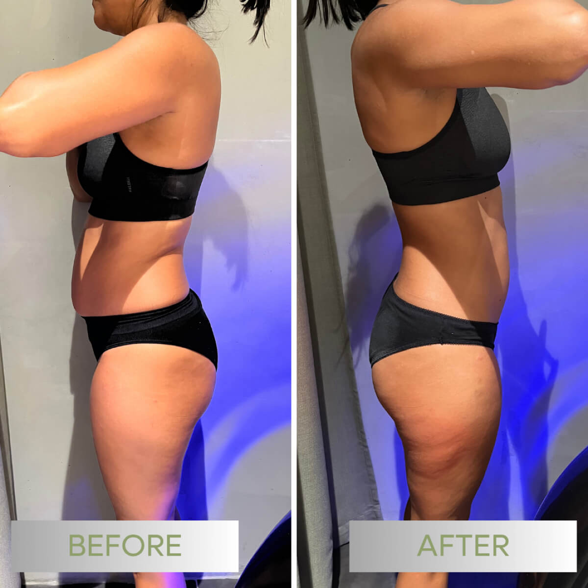 Befit-avantapres-001c